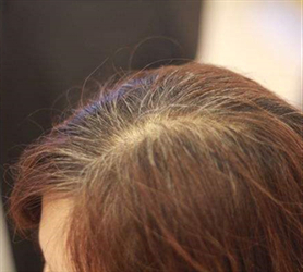 長(zhǎng)白髮是因為缺少維生素？原因終於找到了